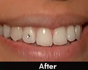 tooth jewellery after